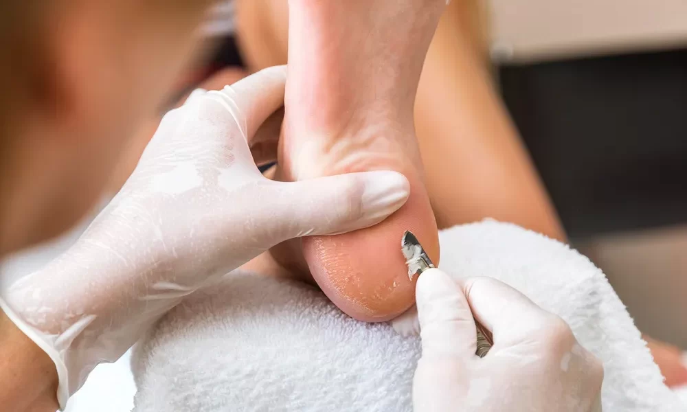 Retargeting Ads for Podiatrists How to Stay Top-of-Mind with Potential Patients