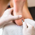 Retargeting Ads for Podiatrists How to Stay Top-of-Mind with Potential Patients