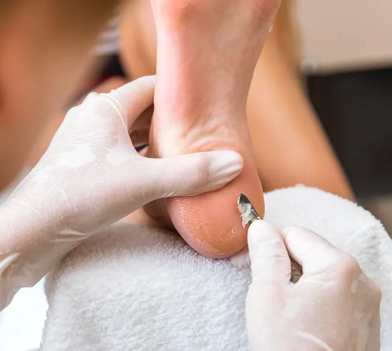 Retargeting Ads for Podiatrists How to Stay Top-of-Mind with Potential Patients
