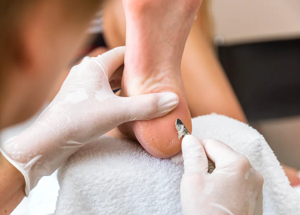 Retargeting Ads for Podiatrists How to Stay Top-of-Mind with Potential Patients
